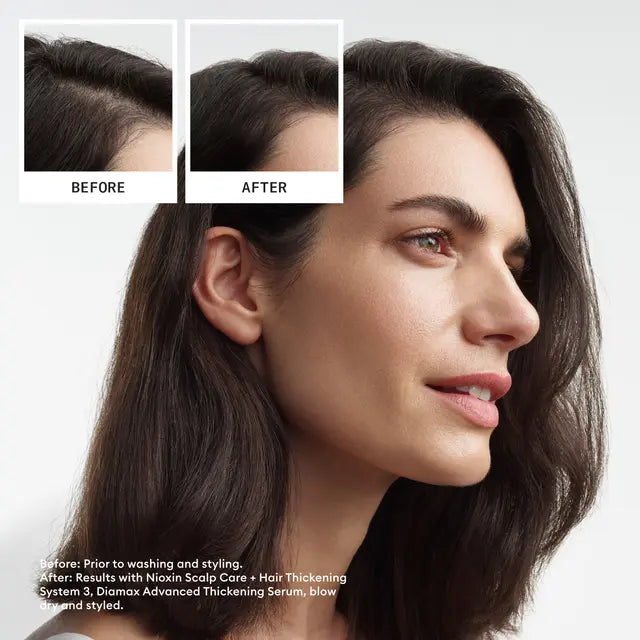 Nioxin Scalp + Hair Thickening System 3 Trio Pack LIGHT THINNING COLOURED / DRY / DAMAGED HAIR - Lashmer