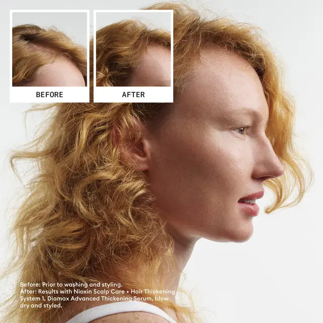 Nioxin Scalp + Hair Thickening System 1 LIGHT THINNING LIGHT THINNING / NATURAL UNTREATED HAIR - Lashmer